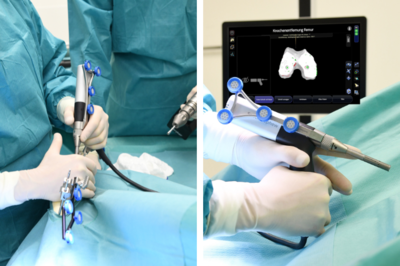 Knie-Tep Simmerath - Cori Roboter