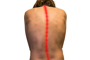 Wirbelsäulenzentrum - Behandlungsmethoden bei Skoliose